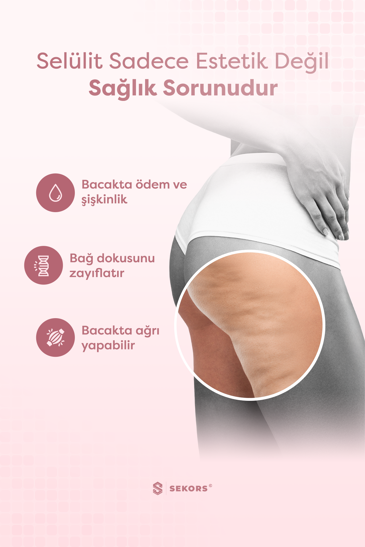 Sekors Bacak İnceltici & Selülit Giderici Masaj Aleti