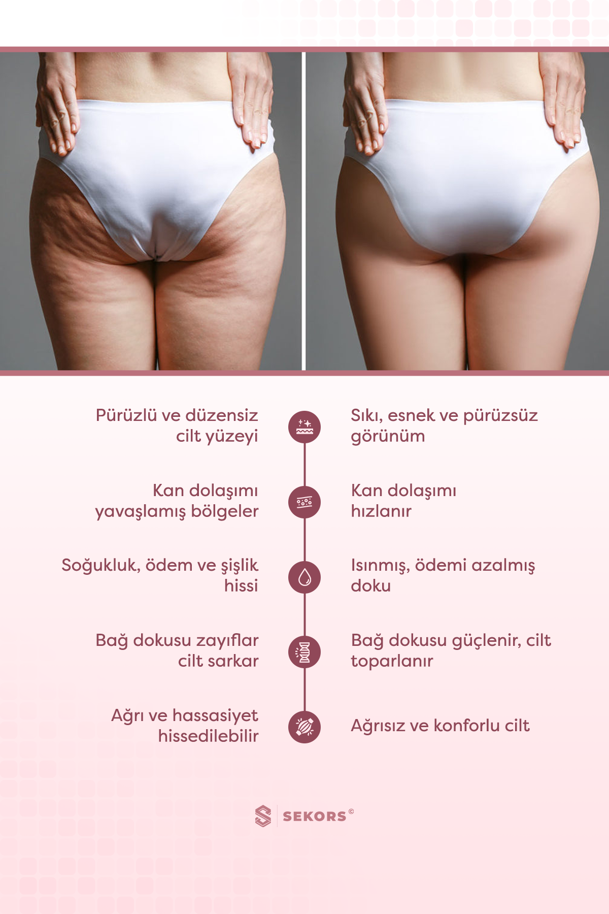 Sekors Bacak İnceltici & Selülit Giderici Masaj Aleti